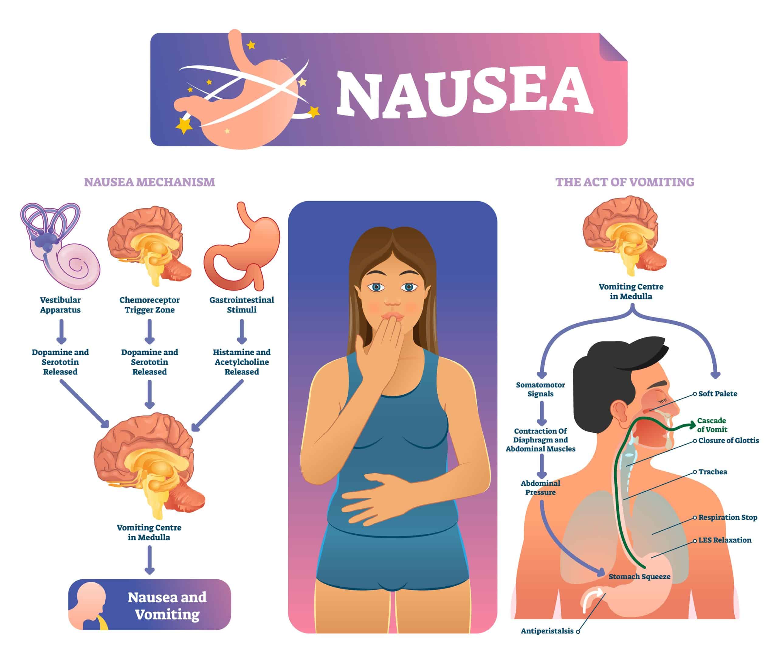 CTZ role in nausea and vomiting